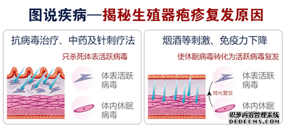 生殖器疱疹病毒治疗